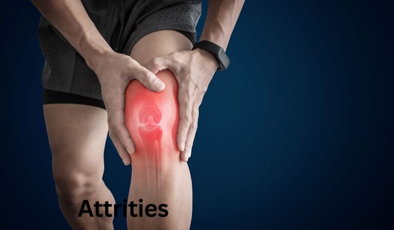 What Is Attrities? A Complete Guide to Its Meaning, Features, and Uses in 2026 Attrities